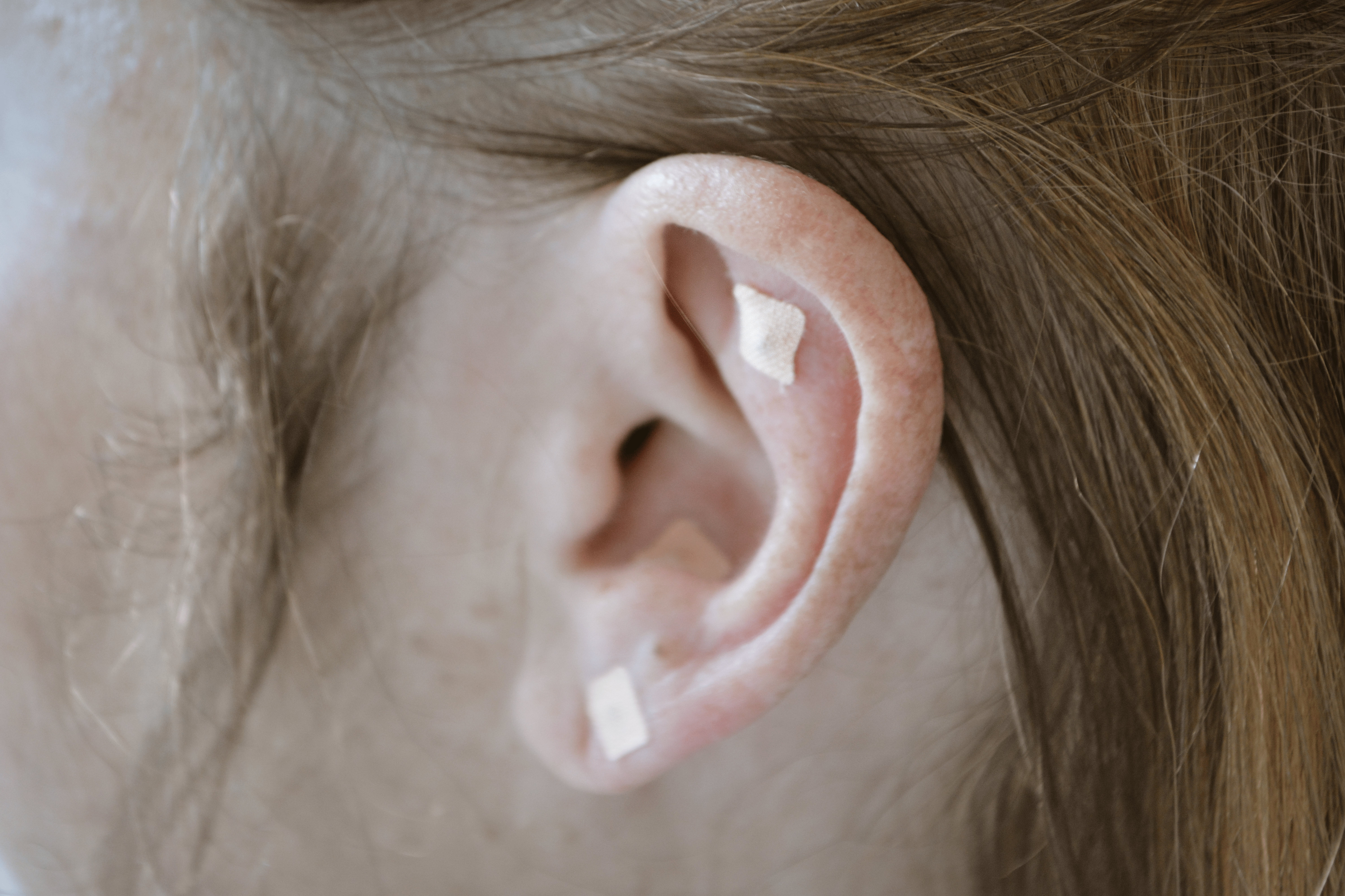 LA RÉFLEXOLOGIE AURICULAIRE EST UNE THÉRAPIE ALTERNATIVE QUI UTILISE DES POINTS RÉFLEXES DANS L'OREILLE POUR STIMULER LA GUÉRISON NATURELLE DU CORPS, SOULAGER LA DOULEUR ET LE STRESS, ET AMÉLIORER LA CIRCULATION SANGUINE.